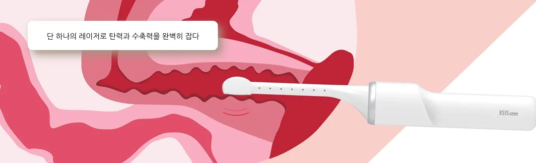 리비브 고주파 레이저 특징