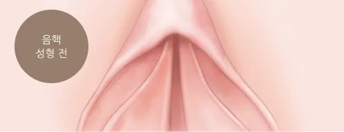 음핵 해부 구조 안내